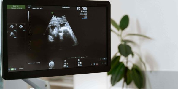 sonogram monitor-min